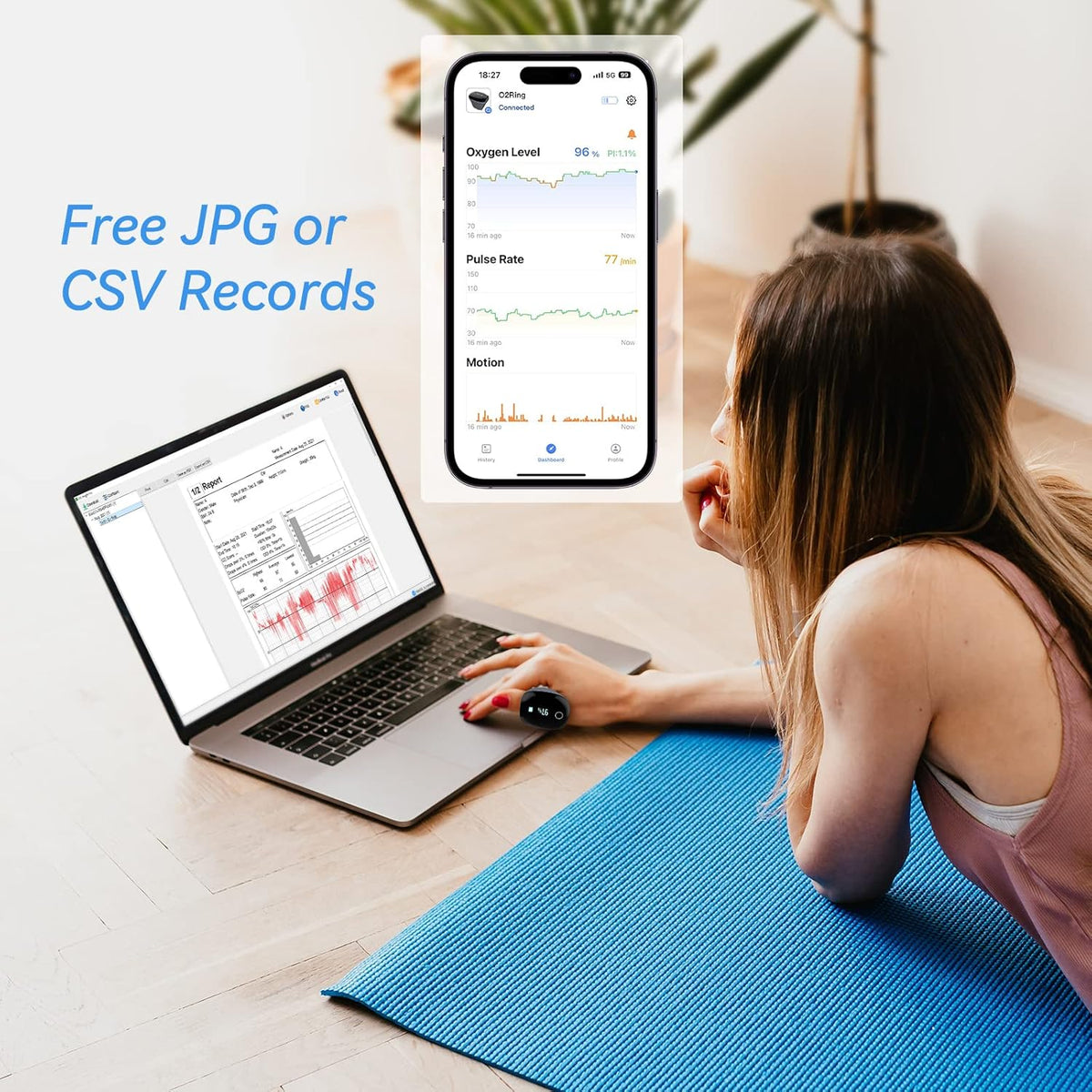 Rechargeable Bluetooth Pulse Oximeter with Reminder J56308